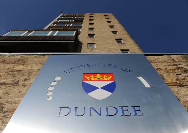 The study, involving Dundee University, aims to understand why some people recover more quickly than others from coronavirus, and why some patients develop subsequent health problems.