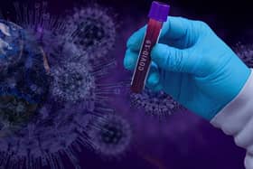 Almost 600 people in Scotland are thought to have caught coronavirus at their place of work but unions claim this is likely just the tip of the iceberg.