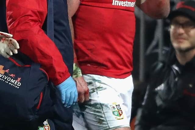 Stuart Hogg going off injured during 2017's New Zealand tour (Photo by David Rogers/Getty Images)