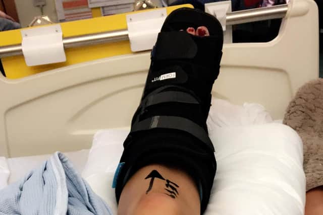 Joanne suffered a cracked tibia and separated bones when MacDonald ran her over